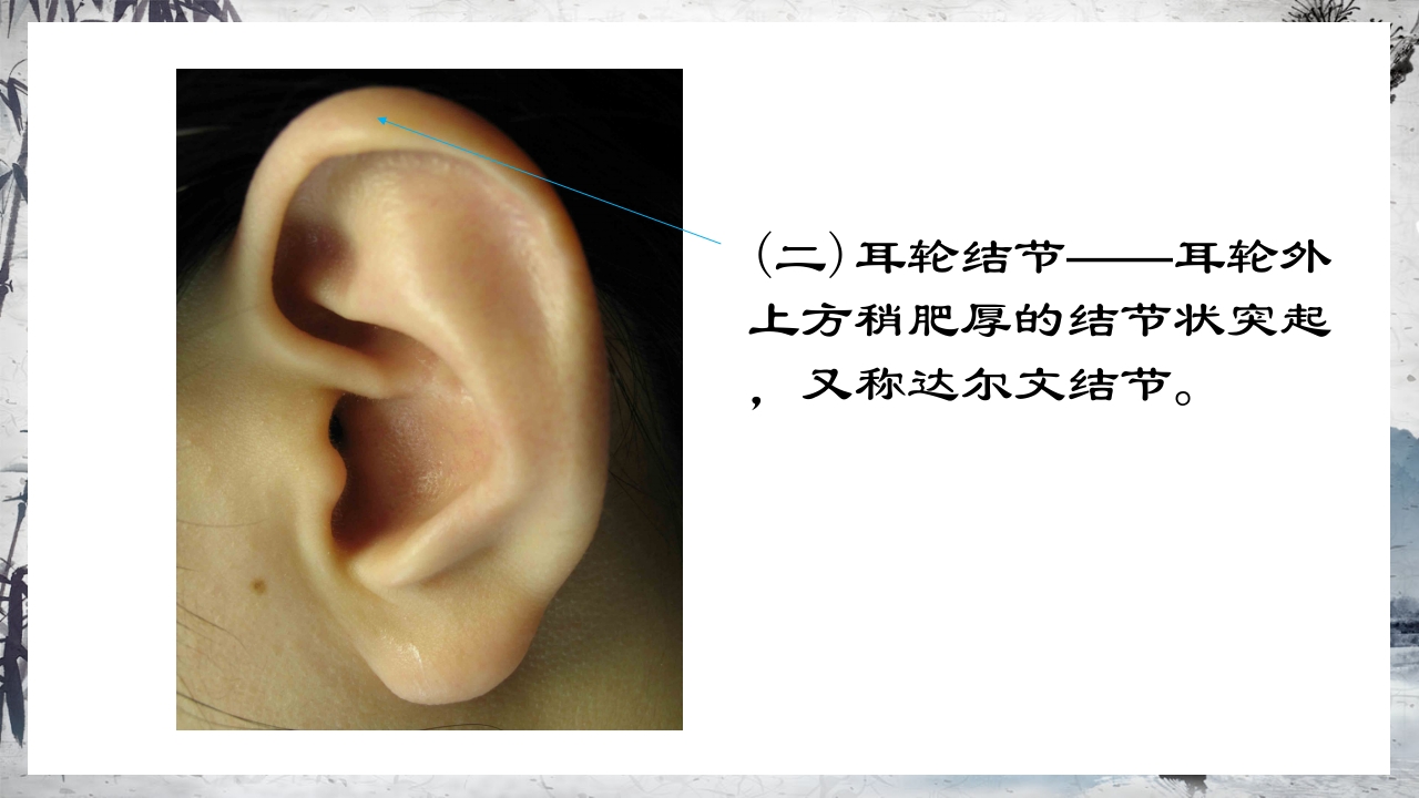 耳穴压豆治疗PPT课件11
