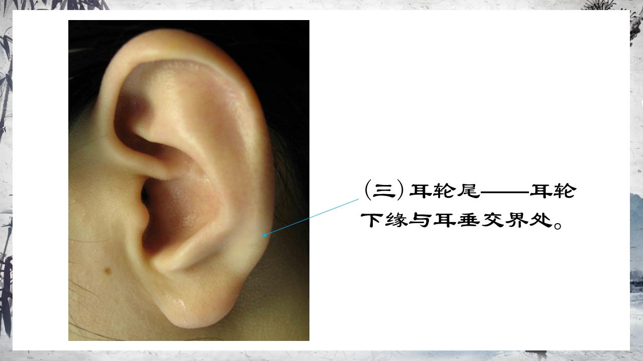 耳穴压豆治疗PPT课件12