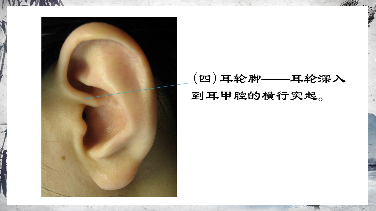 耳穴压豆治疗PPT课件13