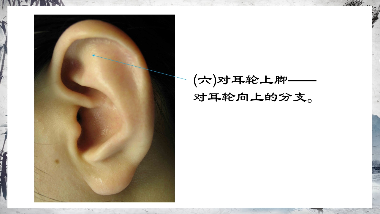 耳穴压豆治疗PPT课件14