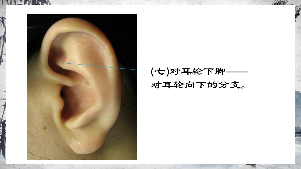 耳穴压豆治疗PPT课件15