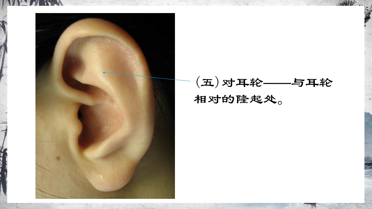 耳穴压豆治疗PPT课件16