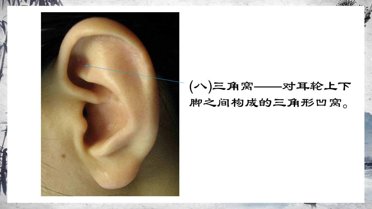 耳穴压豆治疗PPT课件17