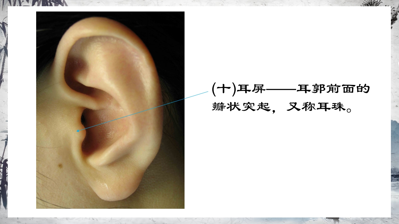 耳穴压豆治疗PPT课件19