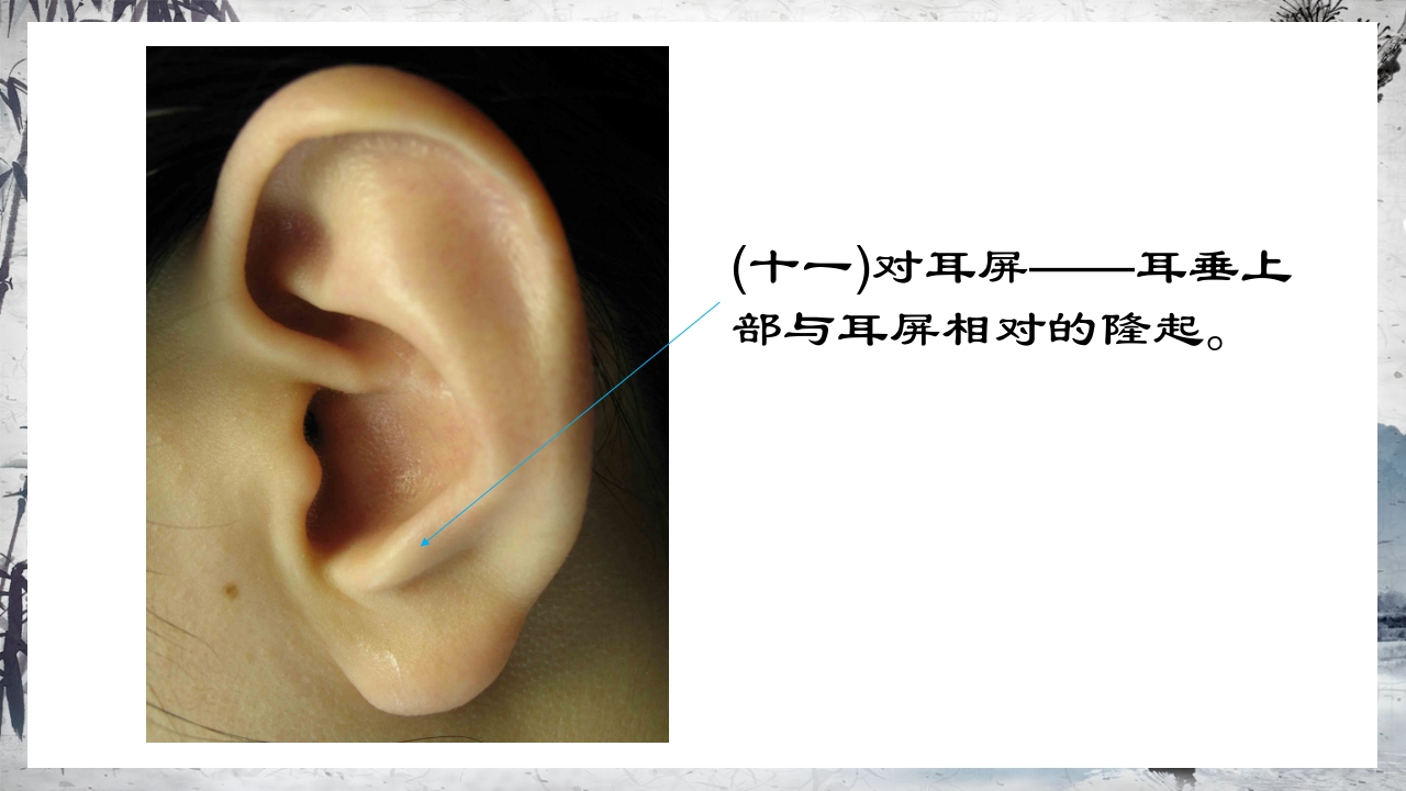 耳穴压豆治疗PPT课件20