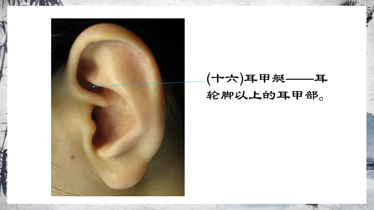 耳穴压豆治疗PPT课件24