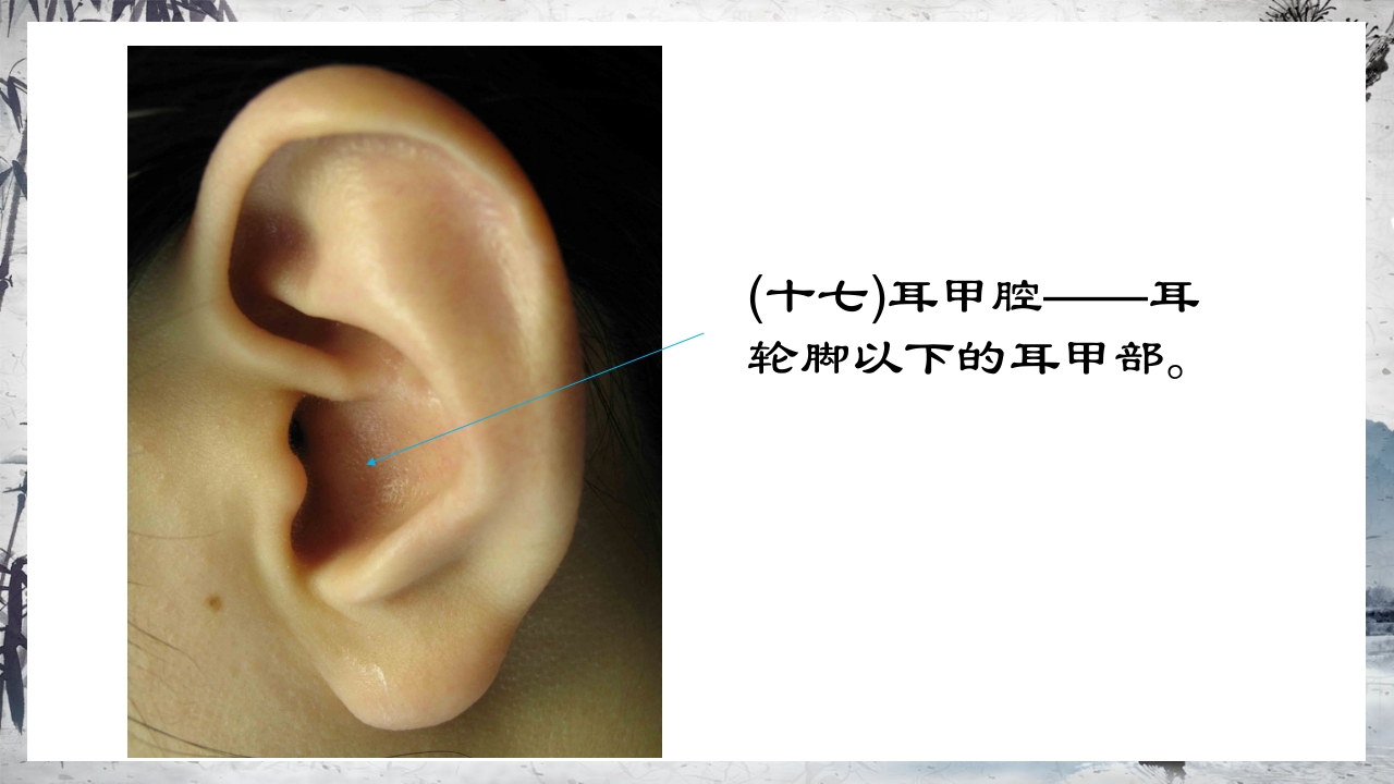 耳穴压豆治疗PPT课件26