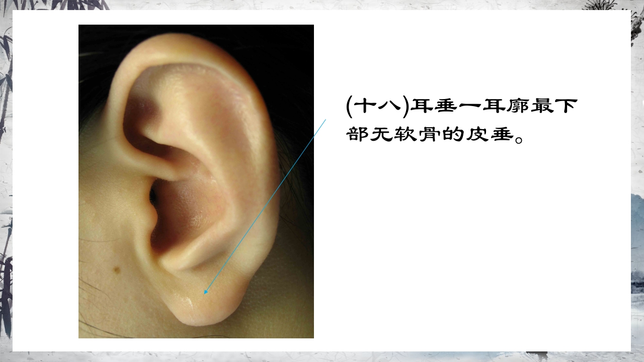 耳穴压豆治疗PPT课件27