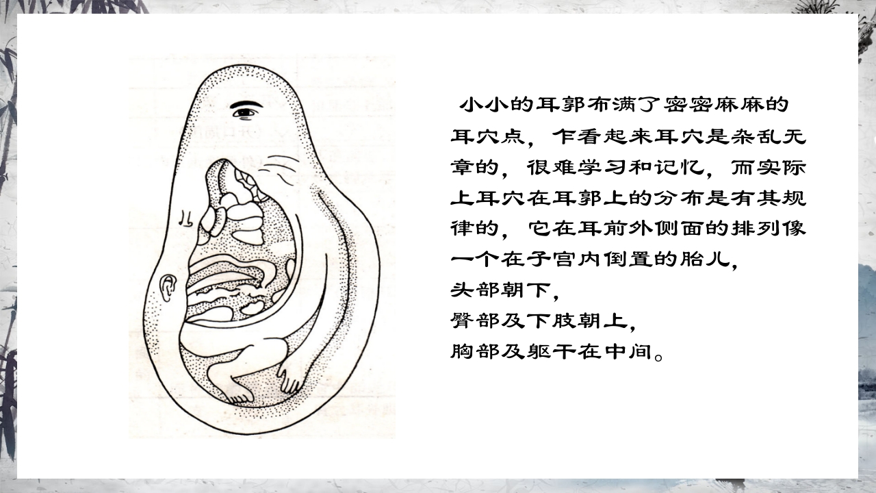 耳穴压豆治疗PPT课件28
