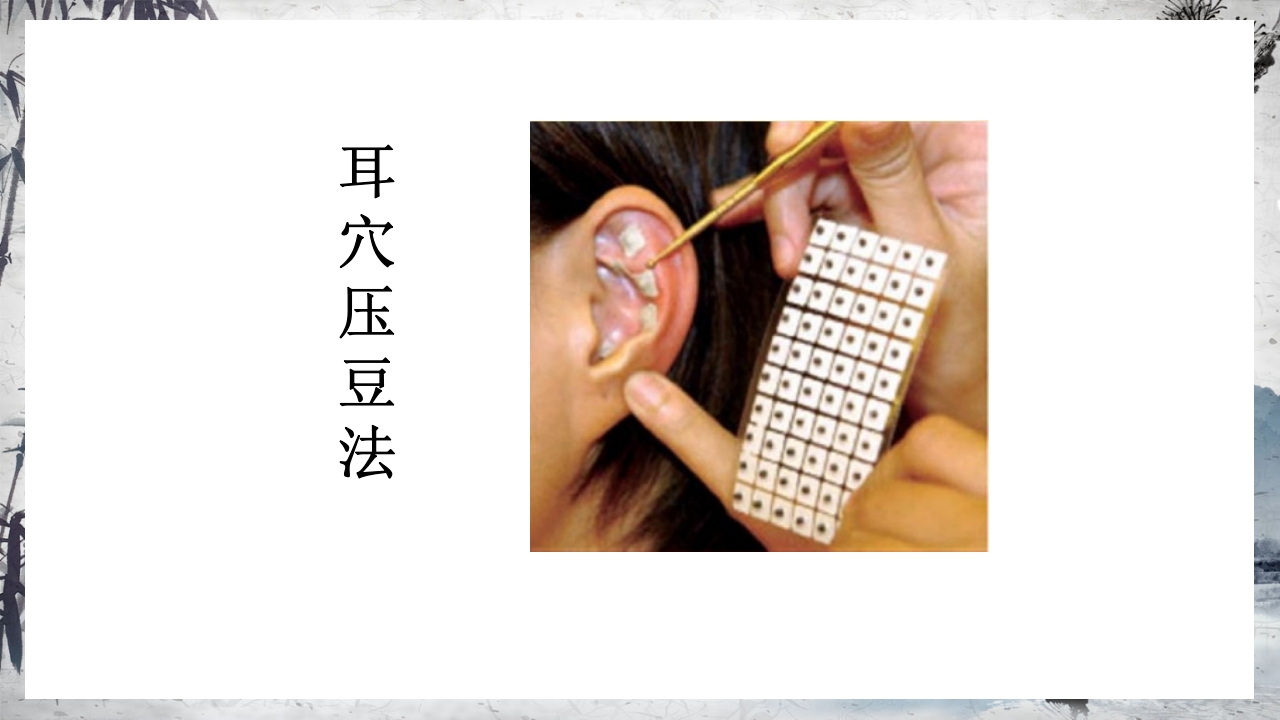 耳穴压豆治疗PPT课件2