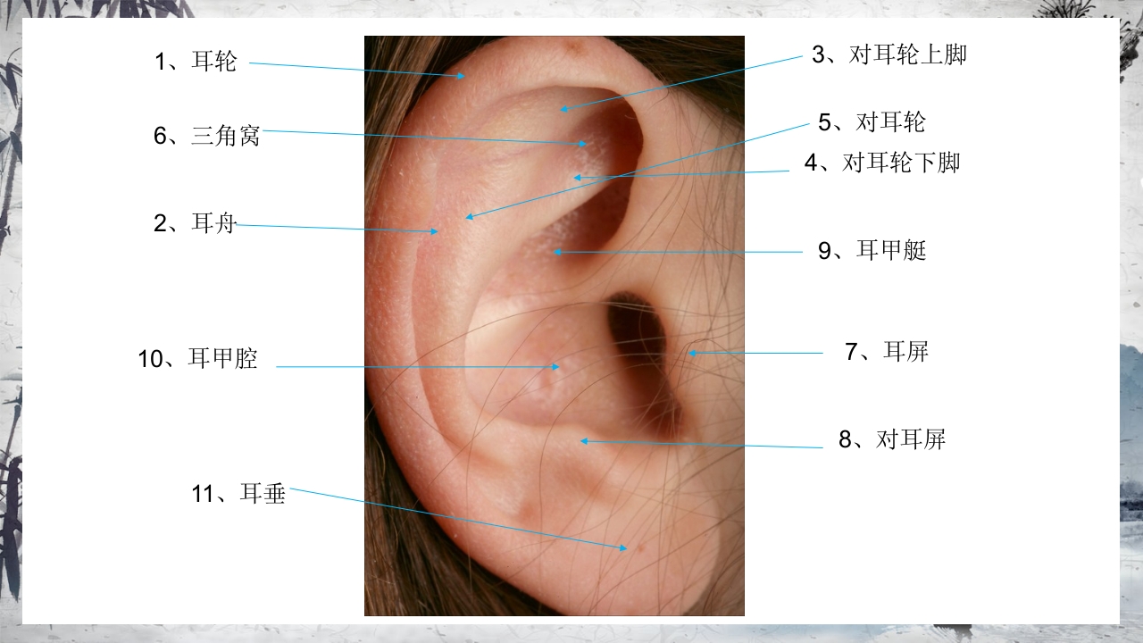 耳穴压豆治疗PPT课件31