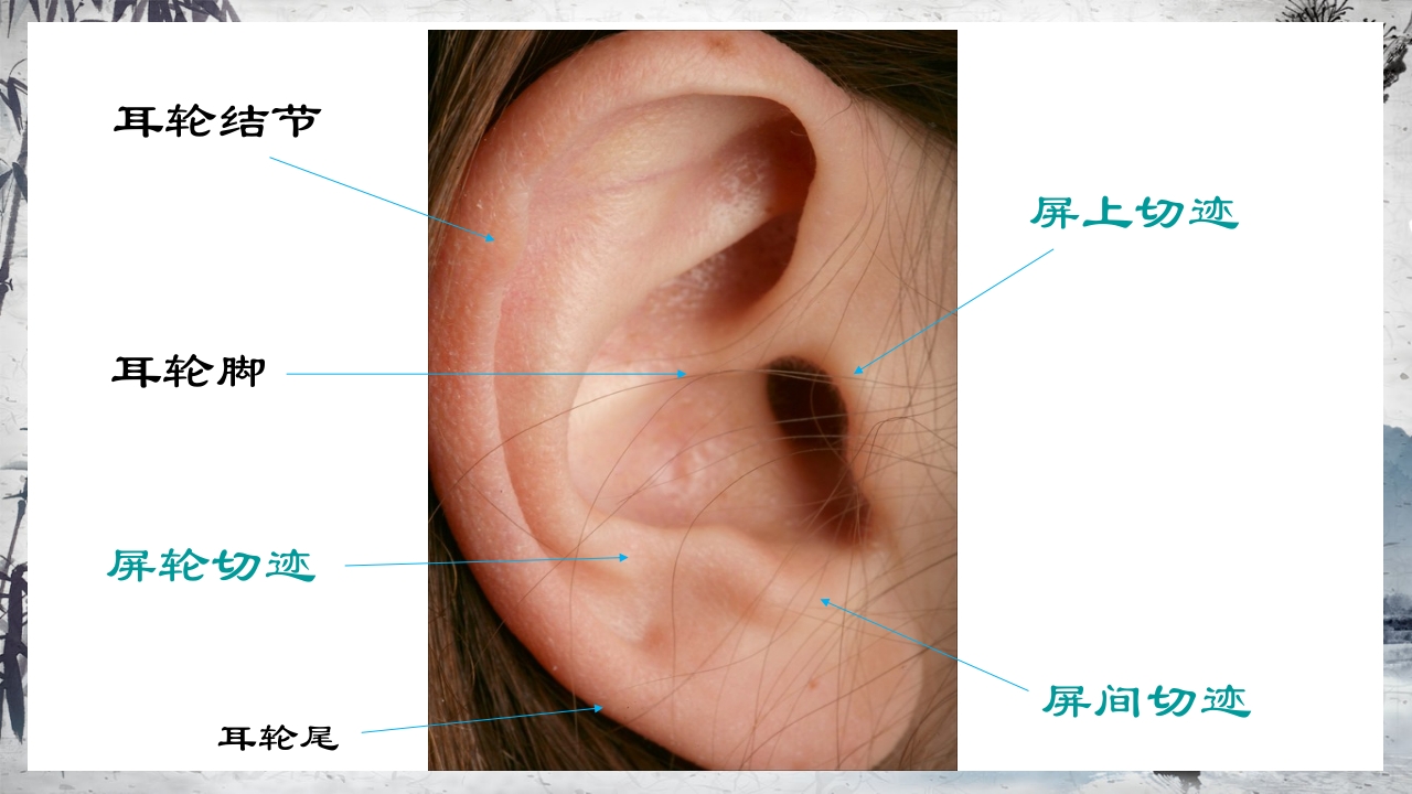 耳穴压豆治疗PPT课件32