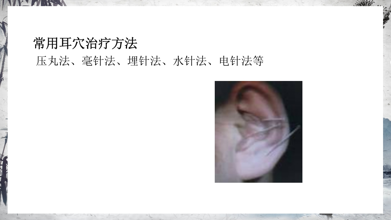 耳穴压豆治疗PPT课件40