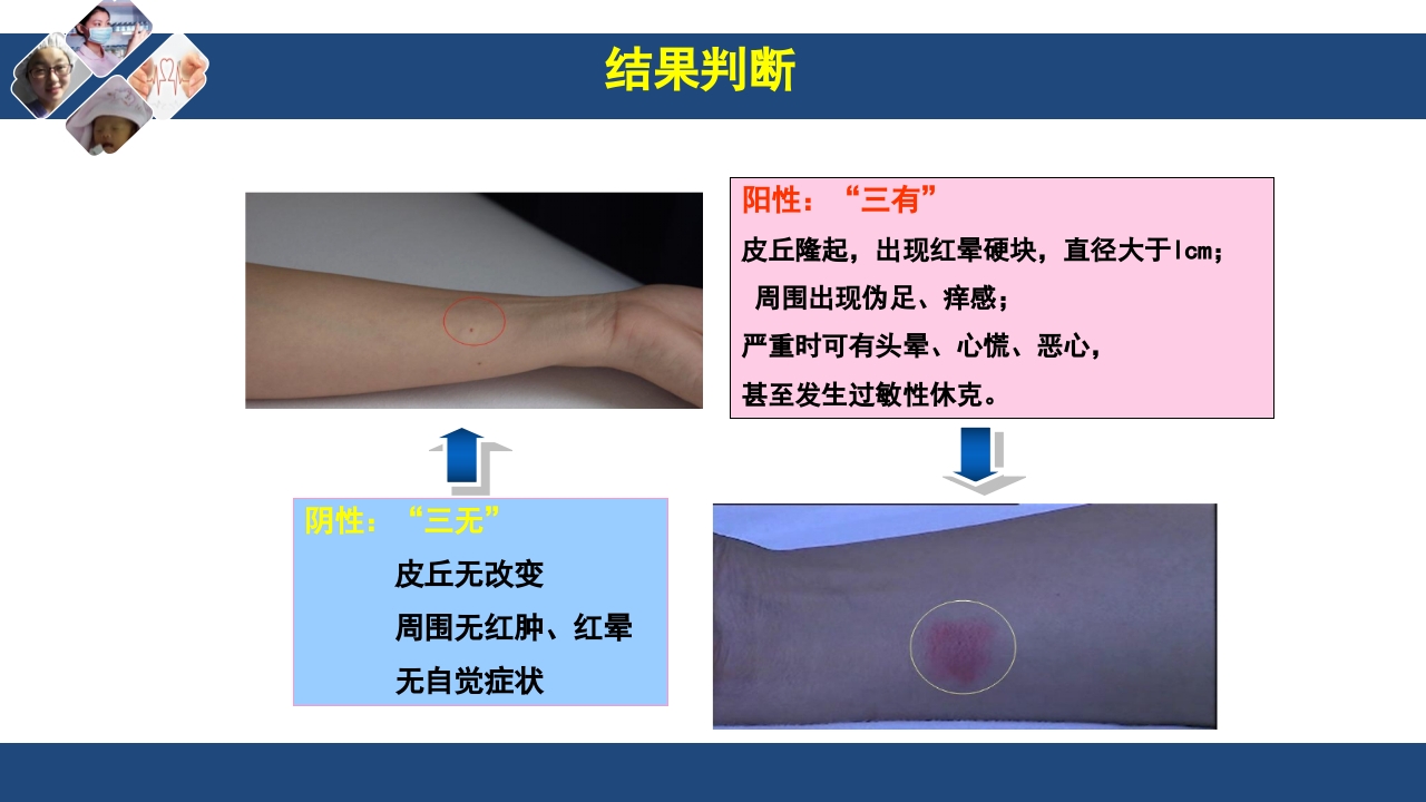 药物过敏试验与过敏反应的处理PPT课件16