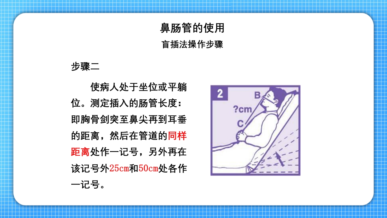 鼻肠管的护理PPT课件10