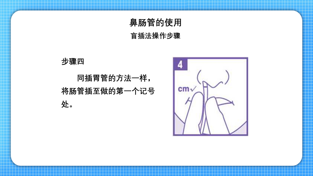 鼻肠管的护理PPT课件12
