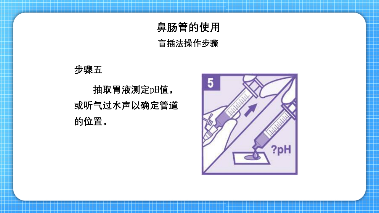 鼻肠管的护理PPT课件13