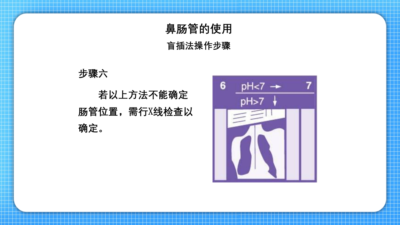 鼻肠管的护理PPT课件14