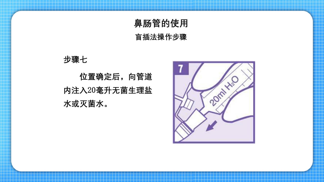 鼻肠管的护理PPT课件15