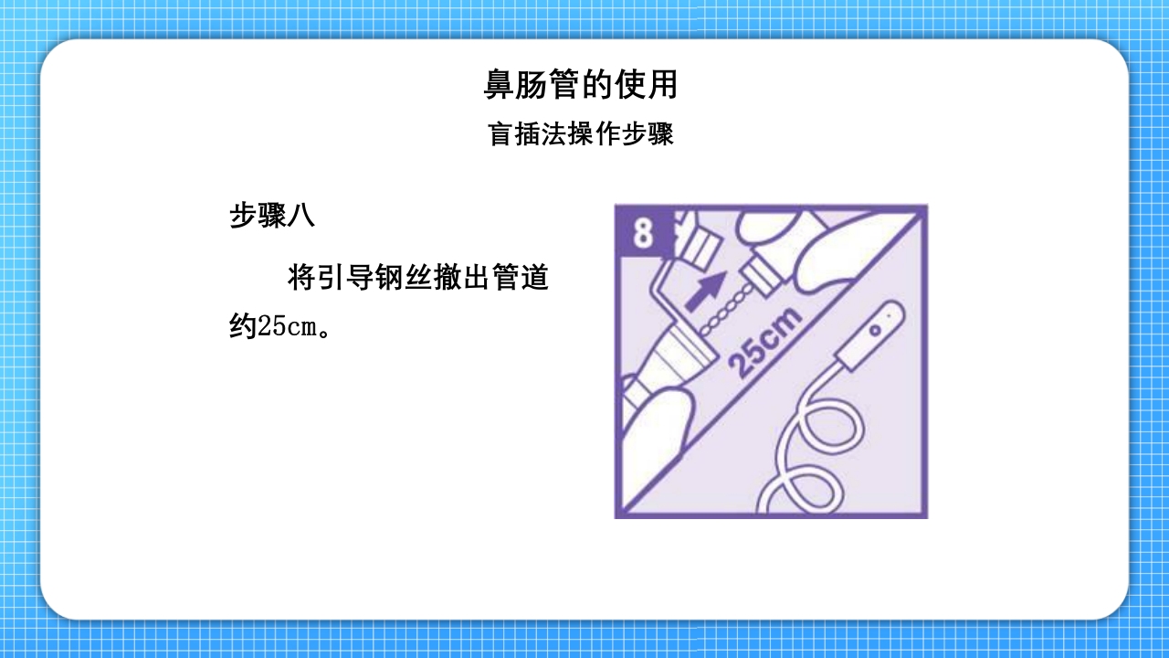 鼻肠管的护理PPT课件16