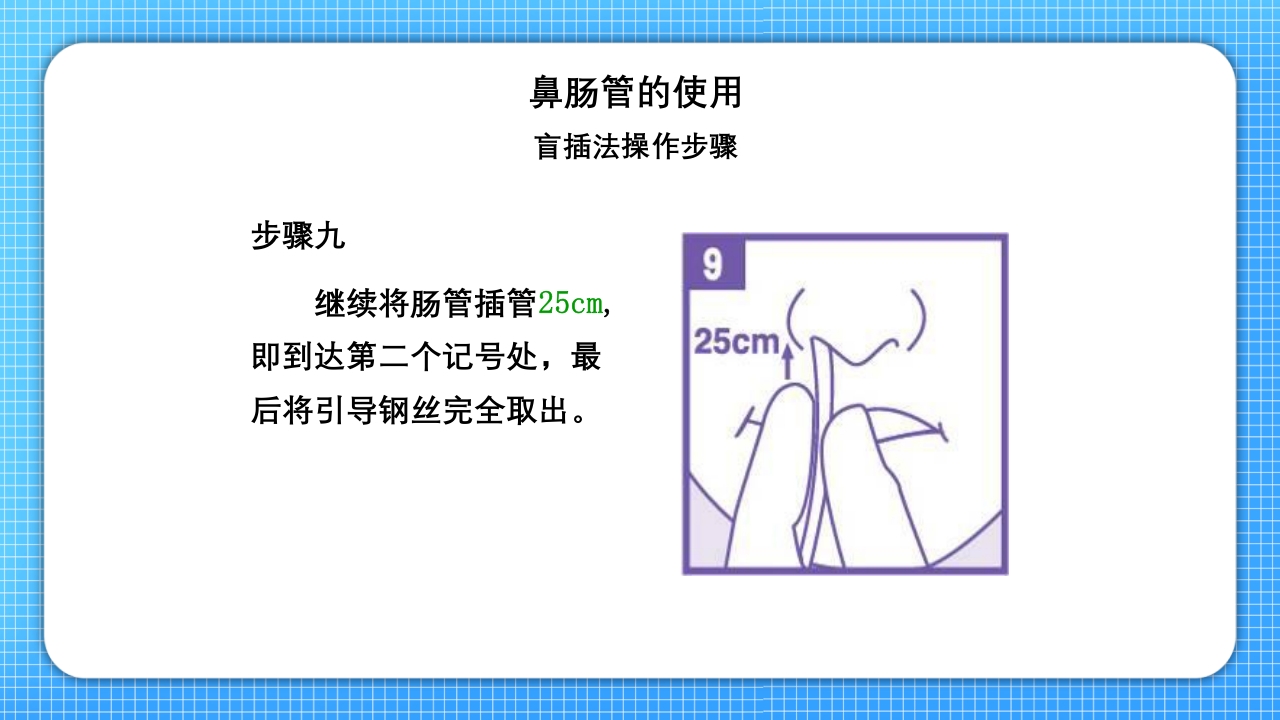 鼻肠管的护理PPT课件17