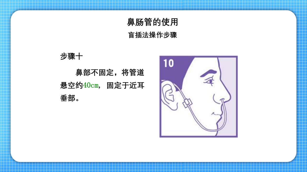 鼻肠管的护理PPT课件18