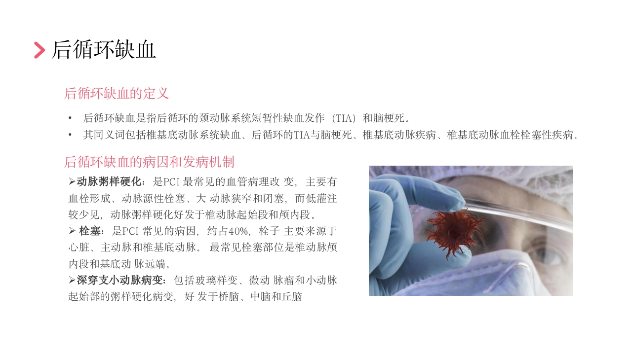 后循环缺血护理查房PPT课件32