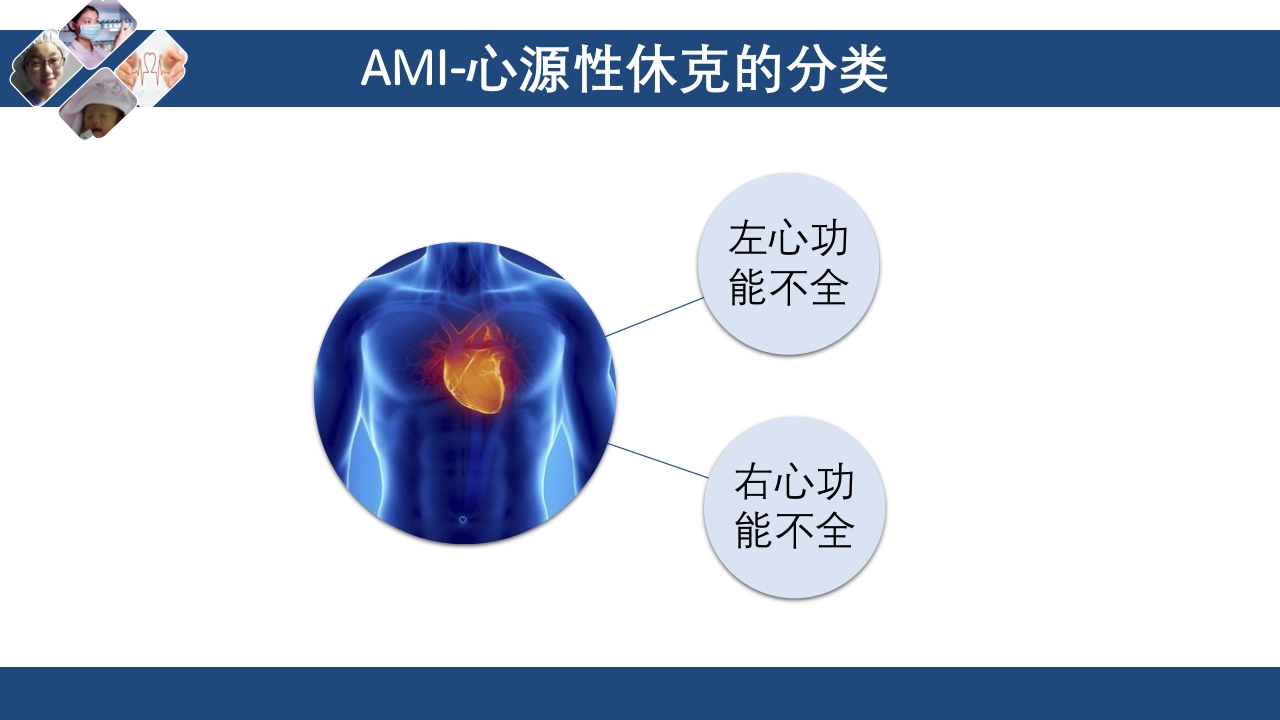 心肌梗死心源性休克ppt课件15