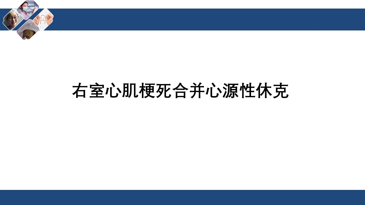 心肌梗死心源性休克ppt课件35