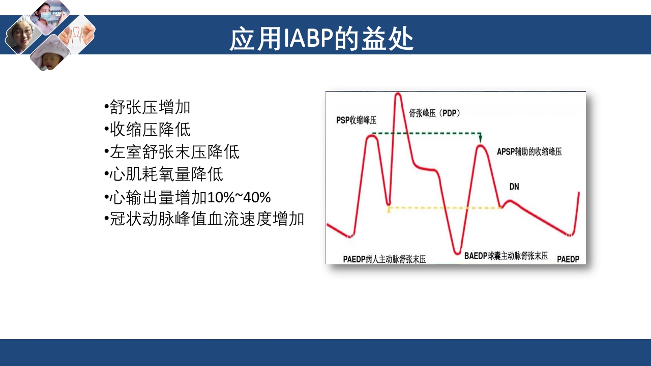 心肌梗死心源性休克ppt课件62