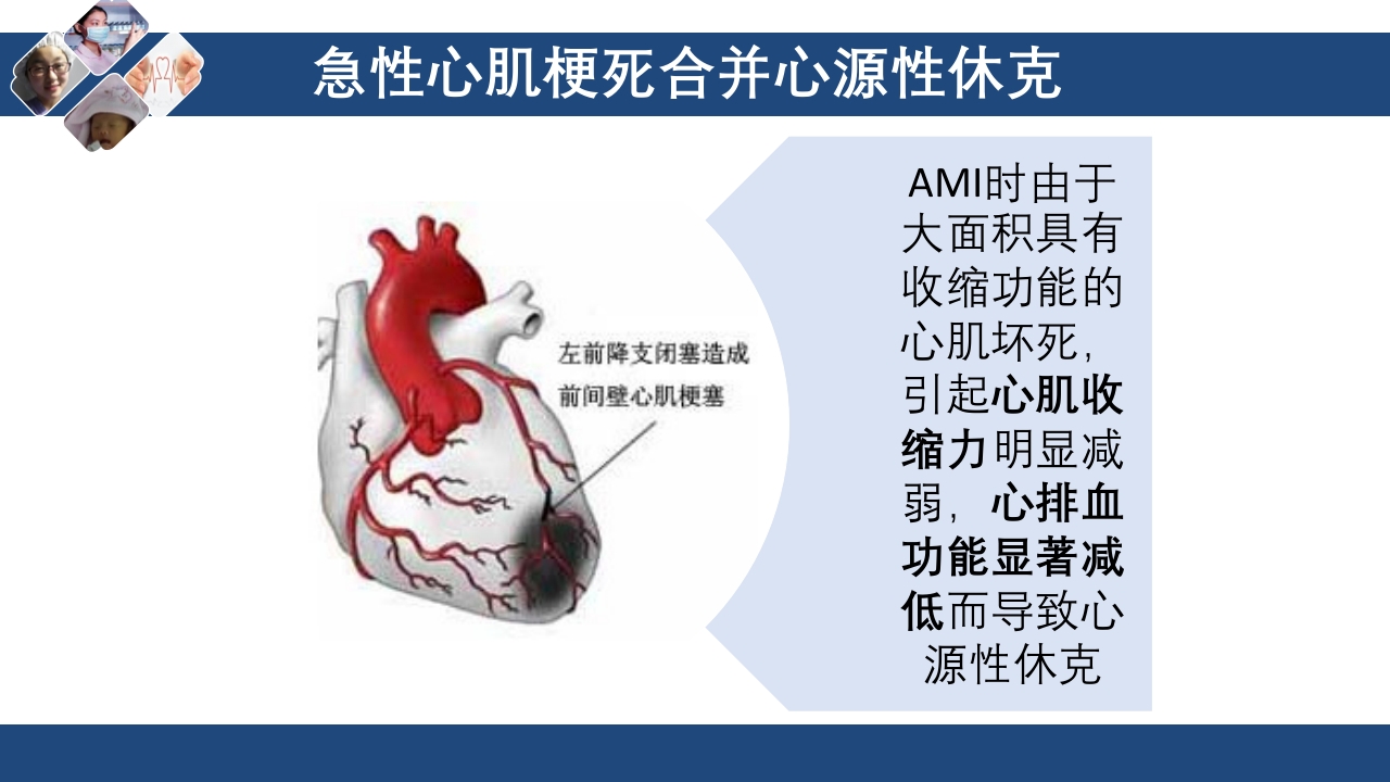 心肌梗死心源性休克ppt课件7