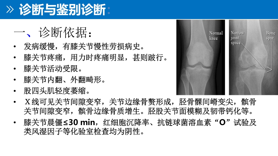 退行性膝关节病变PPT课件14