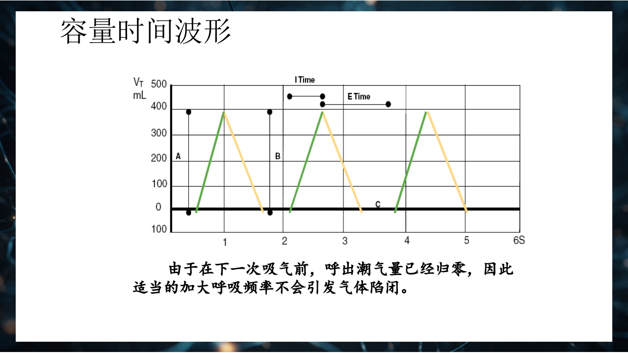 呼吸机原理介绍PPT课件43