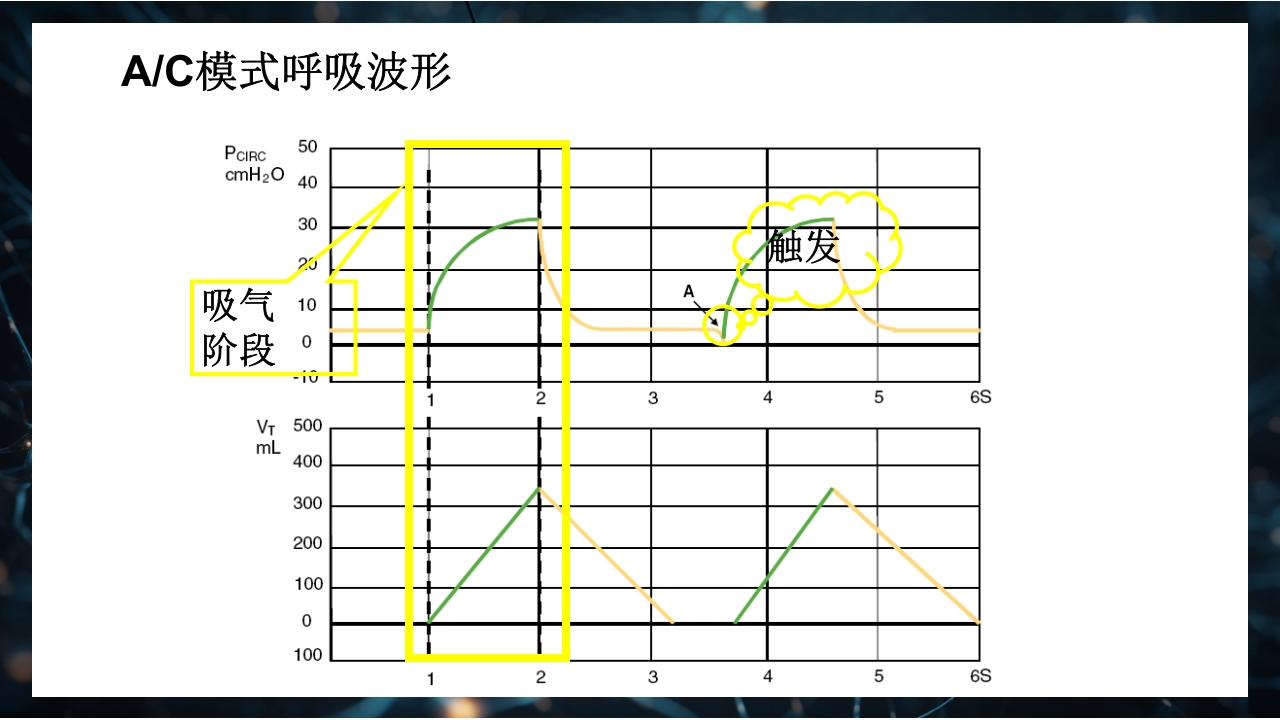 呼吸机原理介绍PPT课件46