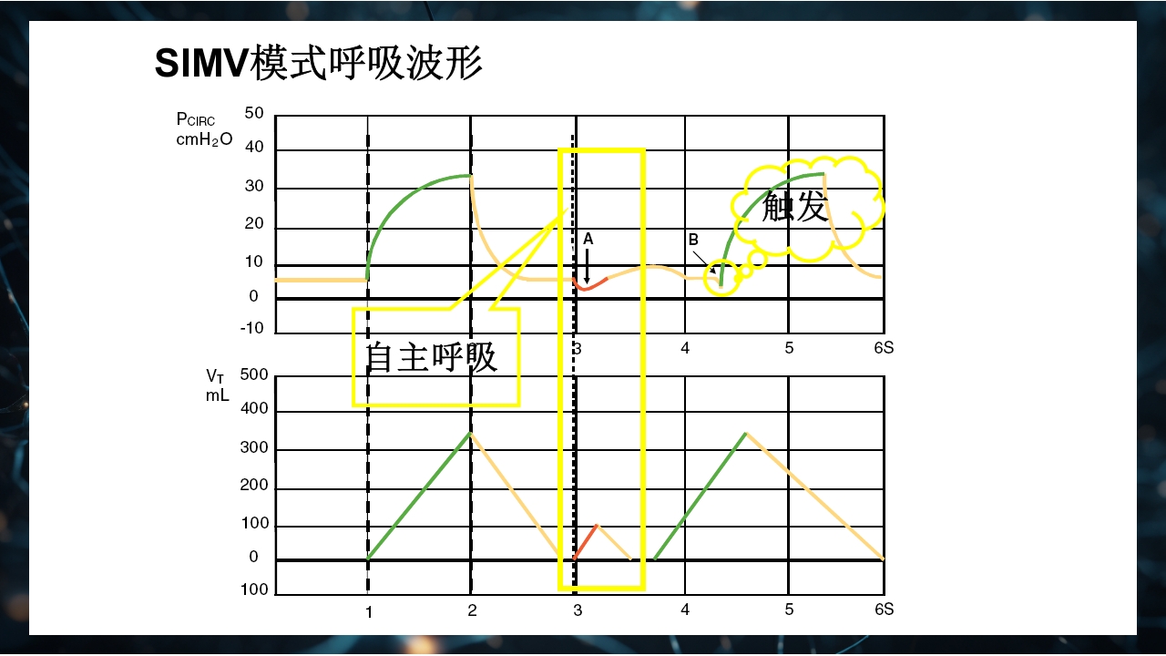 呼吸机原理介绍PPT课件48