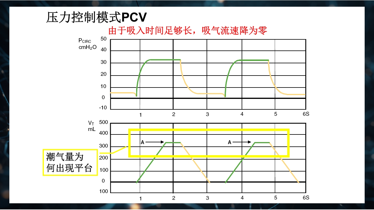 呼吸机原理介绍PPT课件50