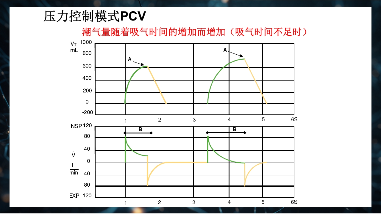 呼吸机原理介绍PPT课件51