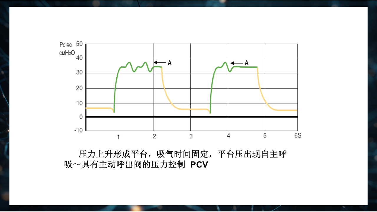 呼吸机原理介绍PPT课件57