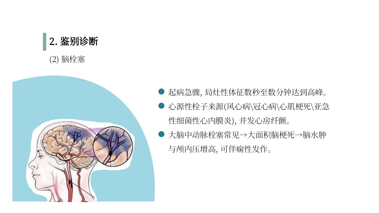 脑梗死PPT课件25