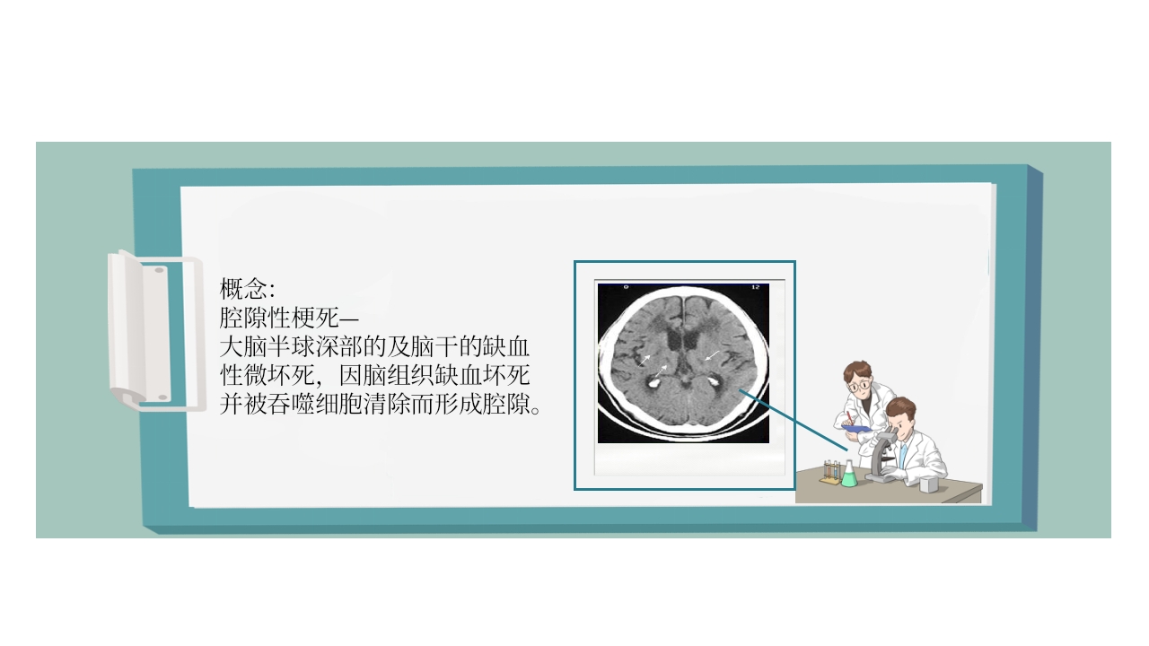 脑梗死PPT课件42