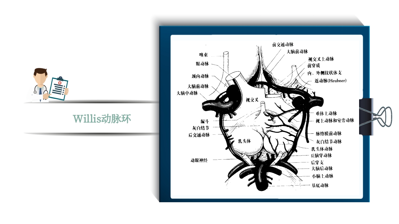 脑梗死PPT课件6