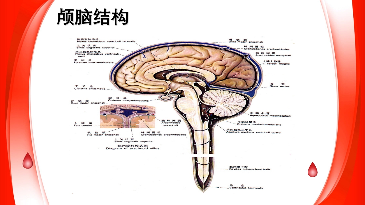蛛网膜下腔出血的护理要点PPT课件2