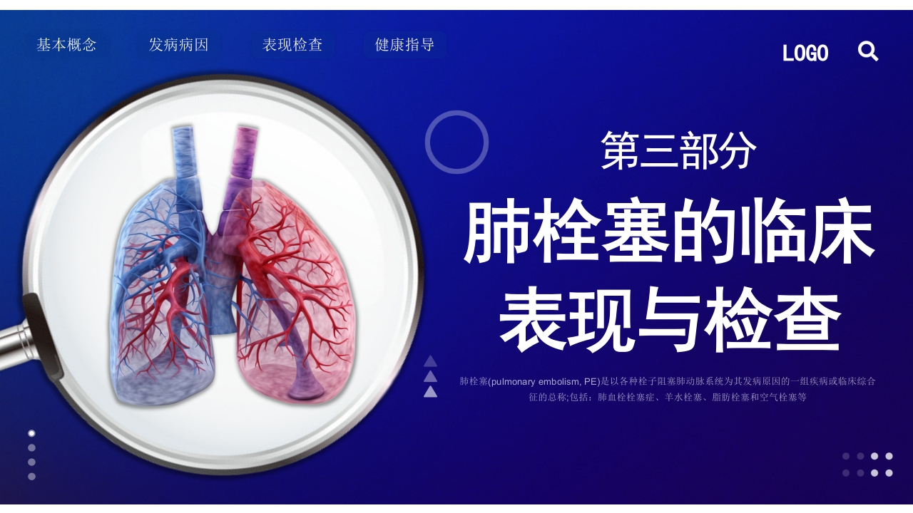 肺栓塞的护理查房PPT课件11