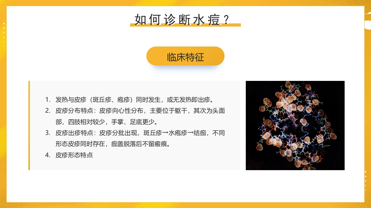 幼儿园预防水痘健康知识PPT课件20