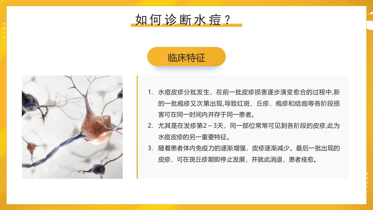 幼儿园预防水痘健康知识PPT课件21