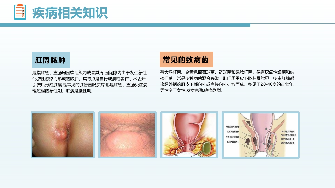 肛肠科护理查房PPT课件4