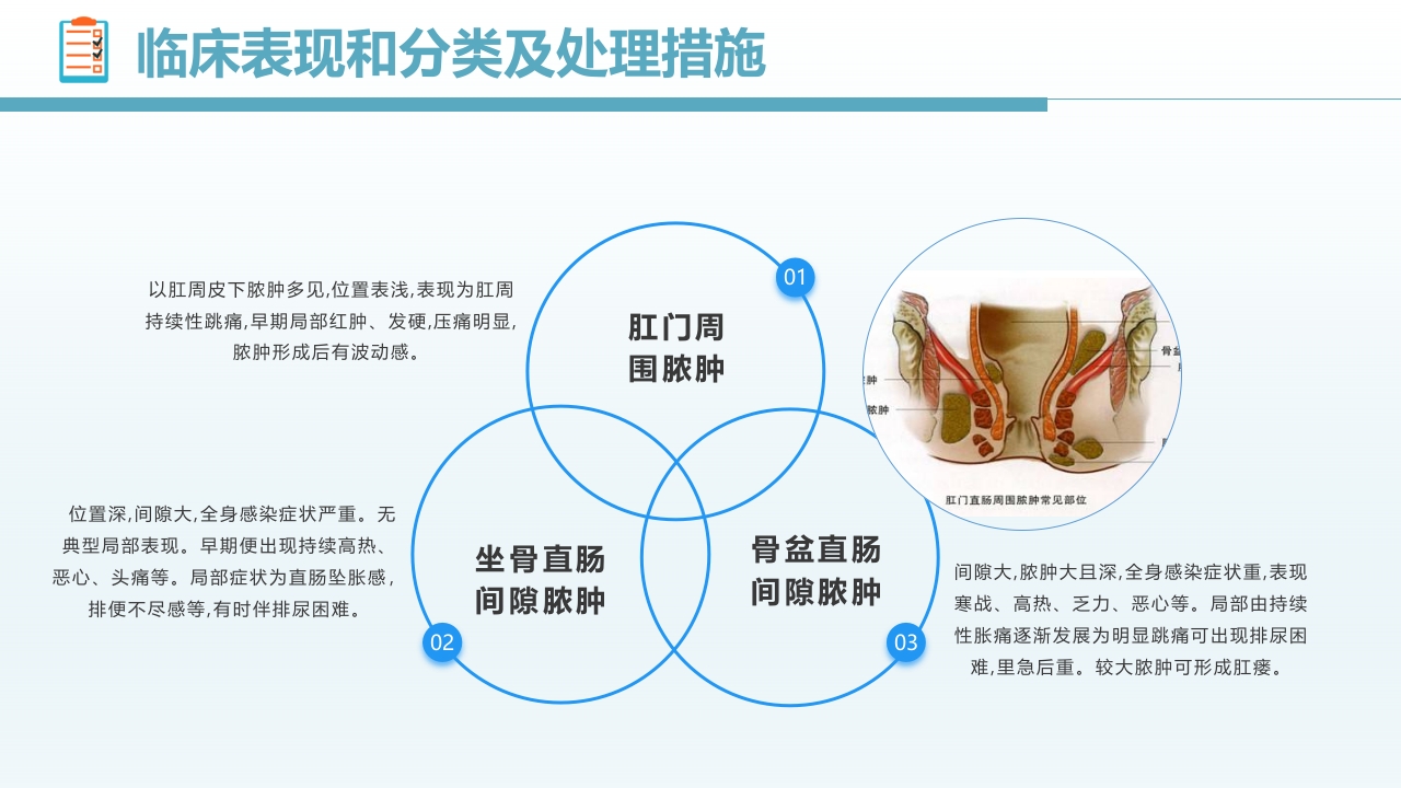 肛肠科护理查房PPT课件7