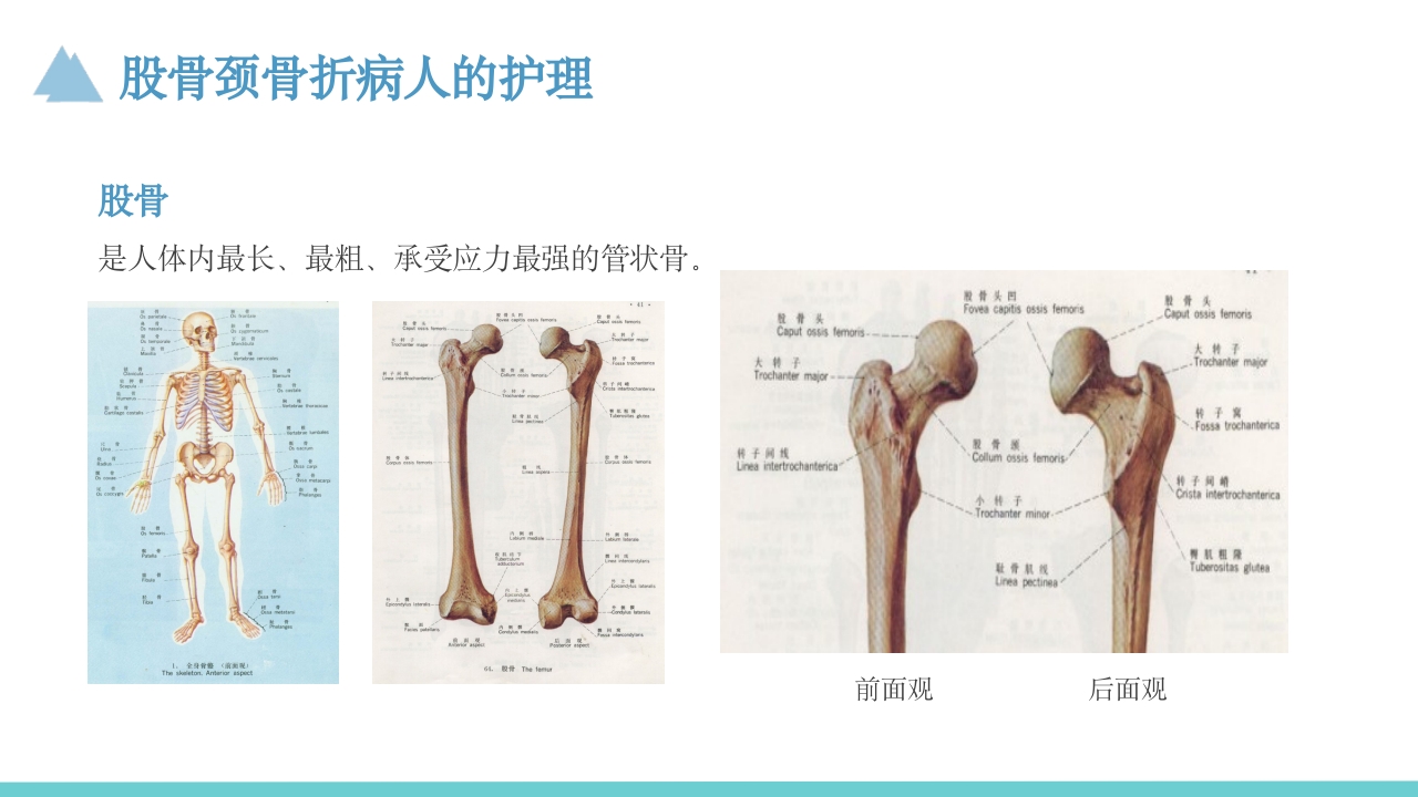 股骨颈骨折护理教学查房PPT课件2