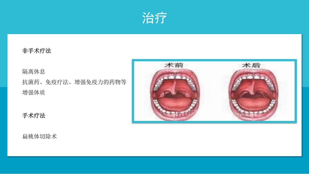 医疗耳鼻喉科护理查房PPT课件10