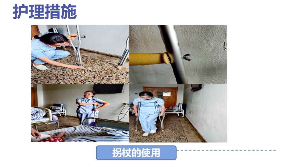 1例左三踝骨折患者的护理查房PPT课件25